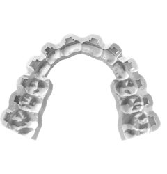 DIBS AI Indirect Bonding