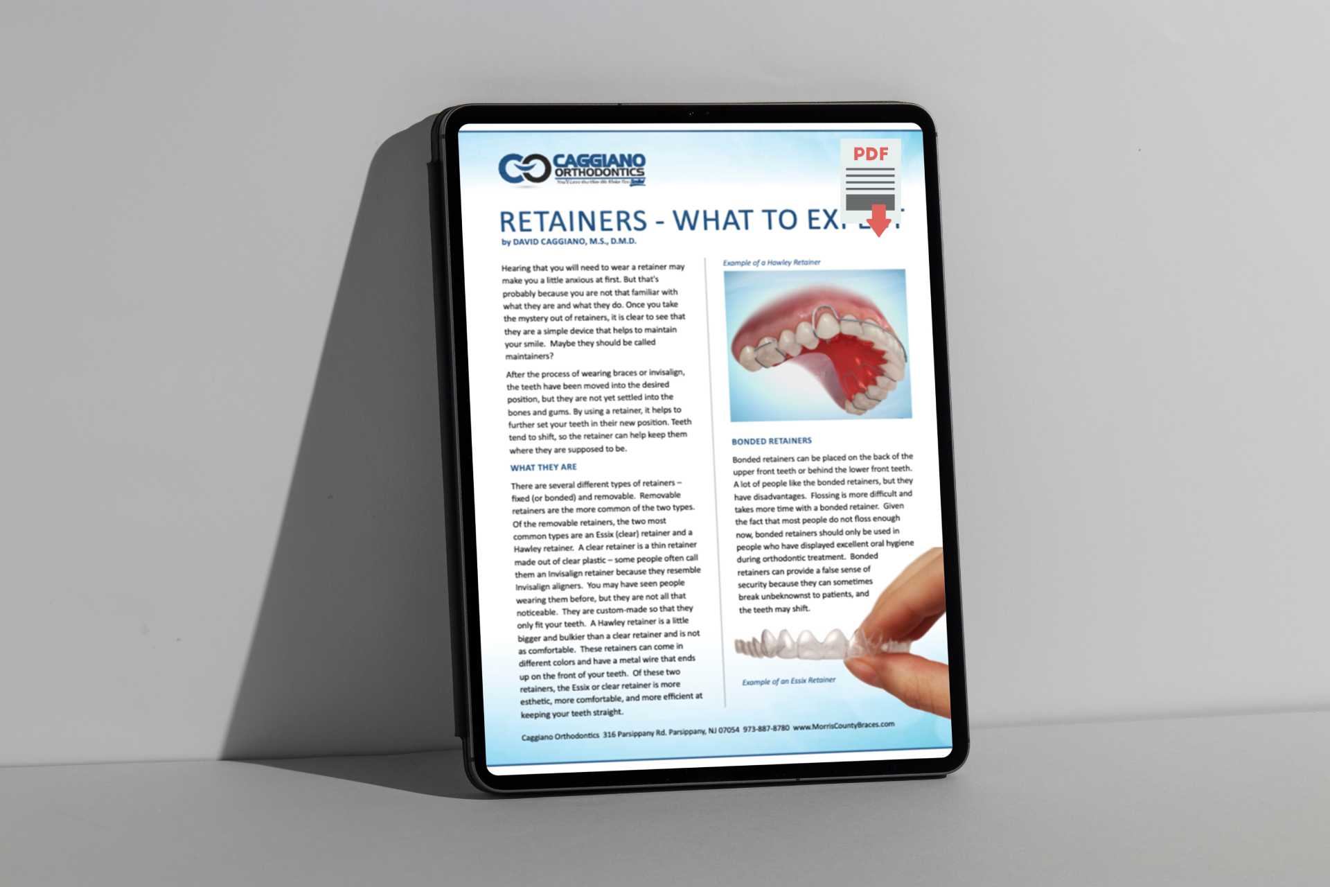 Retainers – What To Expect